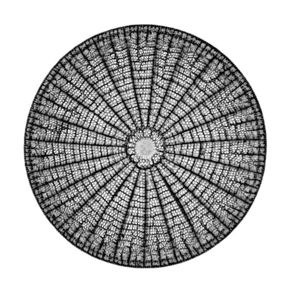 Diatom_-_Arachnoidiscus_sp_-_400x_(16050575150)